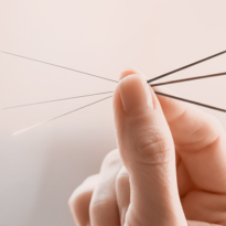 Acupuncture Acupuncture
